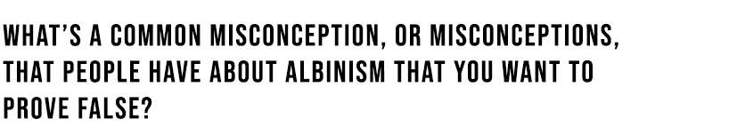 Misconceptions about Albinism